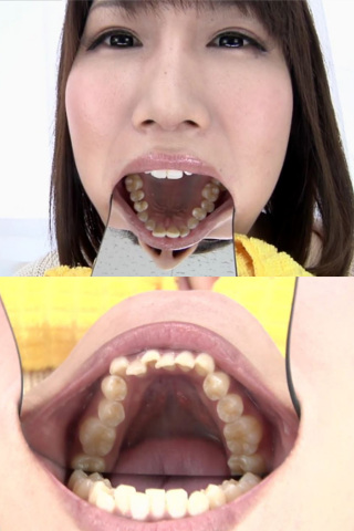 歯観察 みくにちゃん 同人動画