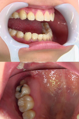 歯フェチ 歯観察 りおん 同人動画