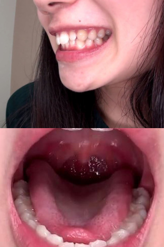 歯フェチ！妹系かなこちゃん 歯・口内自撮り 同人動画