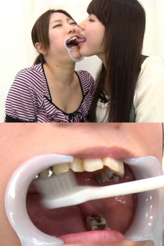 歯フェチ！銀歯たっぷり口内観察レズ　 ひよりちゃん　はるかちゃん 同人動画
