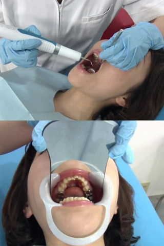 銀歯フェチ処置室 大橋優子 同人動画