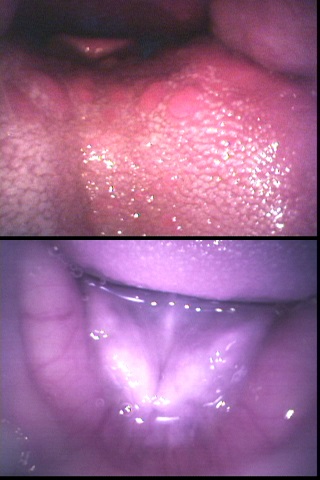 せいかちゃんの口内銀歯観察 同人動画