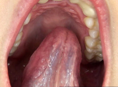 300人のおくち 3