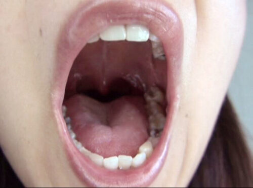 300人のおくち 3