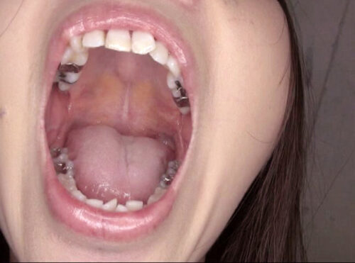 300人のおくち 3