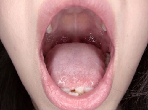 300人のおくち 3